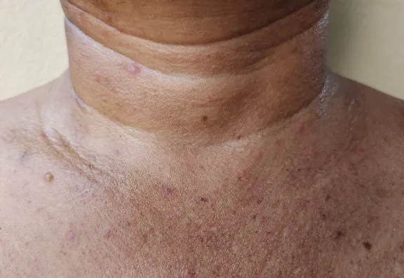 Why Does My Neck Age?