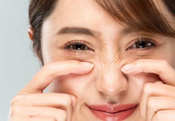 Can You Get Rid of Bunny Lines With Botox? Can You Get Rid of Bunny Lines With Botox?