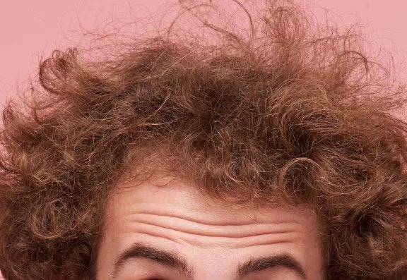 Can You Get Rid of Forehead Lines With Botox? Can You Get Rid of Forehead Lines With Botox?