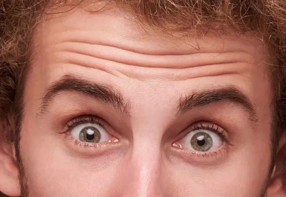 How Long Does Botox Last? How Long Does Botox Last?