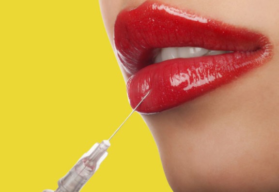 What are dermal fillers? What are dermal fillers?