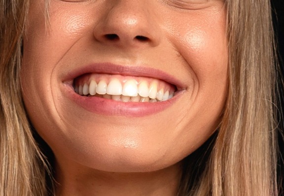 treating 'Teeth Grinding' or 'Bruxism' treating 'Teeth Grinding' or 'Bruxism'