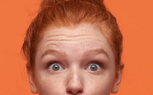 Botox for Forehead Lines